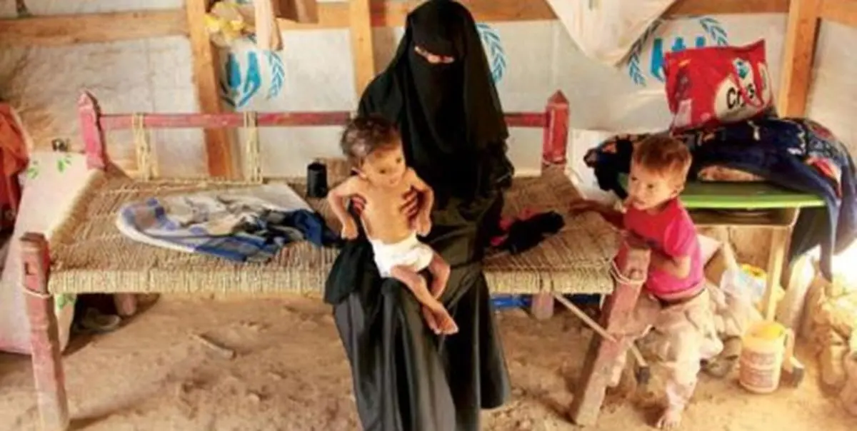 مرگ سالانه هشت هزار زن باردار یمنی در پی عوارض و محاصره