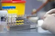 تایید داروی ایرانی برای التهاب ریه مبتلایان کرونا