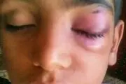 تنبیه‌بدنی؛ تهدید سلامت روان و دلزدگی از مدرسه
