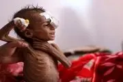 بزرگ‌ترین فاجعه انسانی در یمن