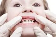 میکروب دهانتان کم است یا زیاد؟