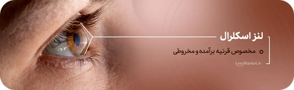 لنز داخل چشم چیست؟