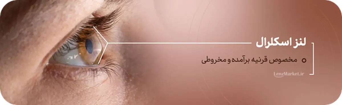 لنز داخل چشم چیست؟