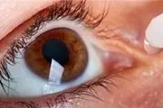 خشکی چشم از مشکلات شایع در زنان است