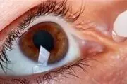 خشکی چشم از مشکلات شایع در زنان است