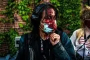 ثبت بیش از ۱۰۰ مورد حمله به خبرنگاران در اعتراضات آمریکا


