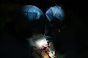افزایش تعداد اهدا و پیوند عضو در ۴ ماه ابتدایی سال جاری
