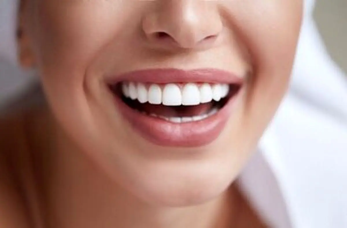 چگونه در خانه دندانهای زرد را سفید کنیم؟