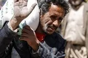 نگاهی به سیاست محاصره عربستان علیه مردم یمن
