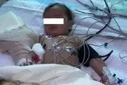 عمل پیوند دست نوزاد ۱۳ ماهه در شیراز با موفقیت انجام شد