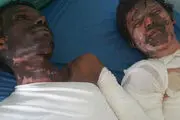 انفجار خط لوله نفت در یمن + تصاویر