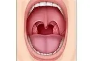 چرا مردان سرطان دهان می گیرند؟