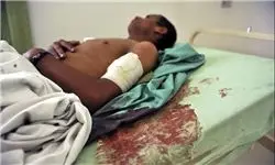 جنگ یمن ۲۳۵۸ شهروند را قربانی کرد