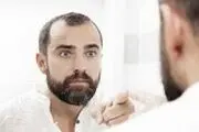 اختلال خود زشت پنداری!