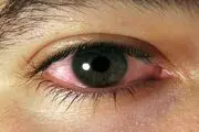 تشخیص بیماری اوتیسم به وسیله چشم‌ها
