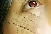 چگونه باید از پوست خشک مراقبت کرد؟ 