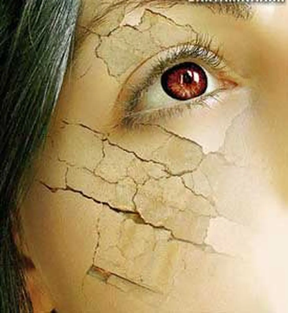 چگونه باید از پوست خشک مراقبت کرد؟ 