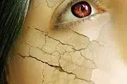 چگونه باید از پوست خشک مراقبت کرد؟ 