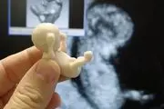همه چیز درباره سونو گرافی بارداری