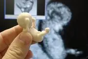 همه چیز درباره سونو گرافی بارداری