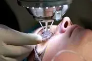 کدام عمل لیزری چشم، برای حذف عینک گزینه مناسب‌تری است؟!
