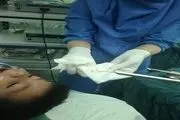 
خروج سکه از مری کودک 2 ساله

