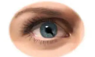 آب‌مروارید(cataract) چیست؟