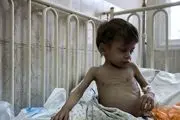 یک سوم کودکان فلسطینی دچار سوء تغذیه هستند