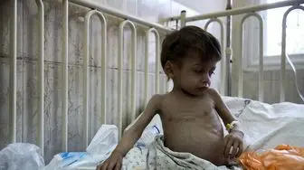 یک سوم کودکان فلسطینی دچار سوء تغذیه هستند