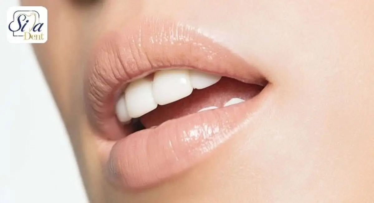 ایمپلنت دندان چیست؟

