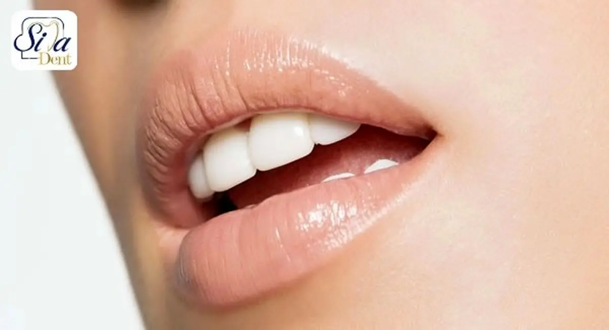 ایمپلنت دندان چیست؟

