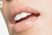 ایمپلنت دندان چیست؟

