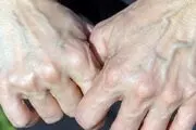 ۱۰ دلیل لرزش دست‌ها که از آن بی‌اطلاعید