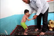 همدلی مردم با معصومه کوچولو