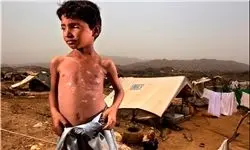 تصاویر تکان‌دهنده از کودکان یمنی گرسنه