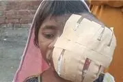توموری به اندازه توپ فوتبال+ عکس