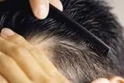 راهکارهای طب ایرانی برای درمان ریزش مو