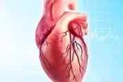 تشخیص میزان تنگی عروق بدون ورود به رگ
