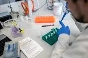 انجام آزمایش کرونا در آزمایشگاه‌های مجاز