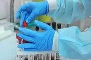 نتایج طرح بیماریابی کرونا
