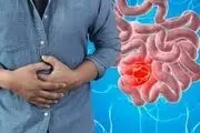 آندوسکوپی و کولونوسکوپی را در اپیدمی کرونا به تعویق نیندازید
