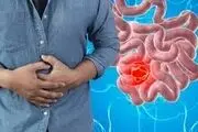 آندوسکوپی و کولونوسکوپی را در اپیدمی کرونا به تعویق نیندازید
