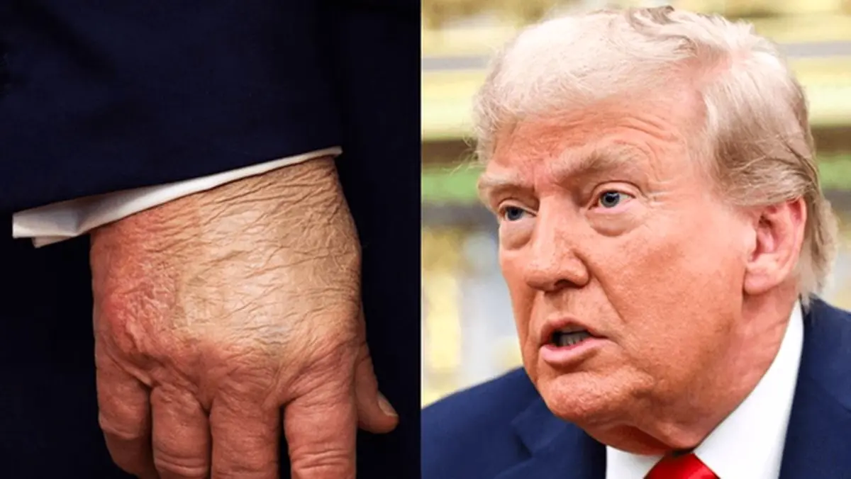 واکنش ترامپ به گرفتن ام‌آر‌آی