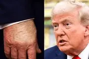 واکنش ترامپ به گرفتن ام‌آر‌آی