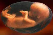 درآمد حاصل از اجاره یک رحم چقدر است؟