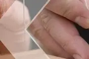 طب سوزنی و تاثیر آن بر بیماری ها