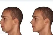 از عمل ژنیوپلاستی  چه می‌دانید؟