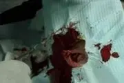 مردی که گوش همسر خود را برید!
