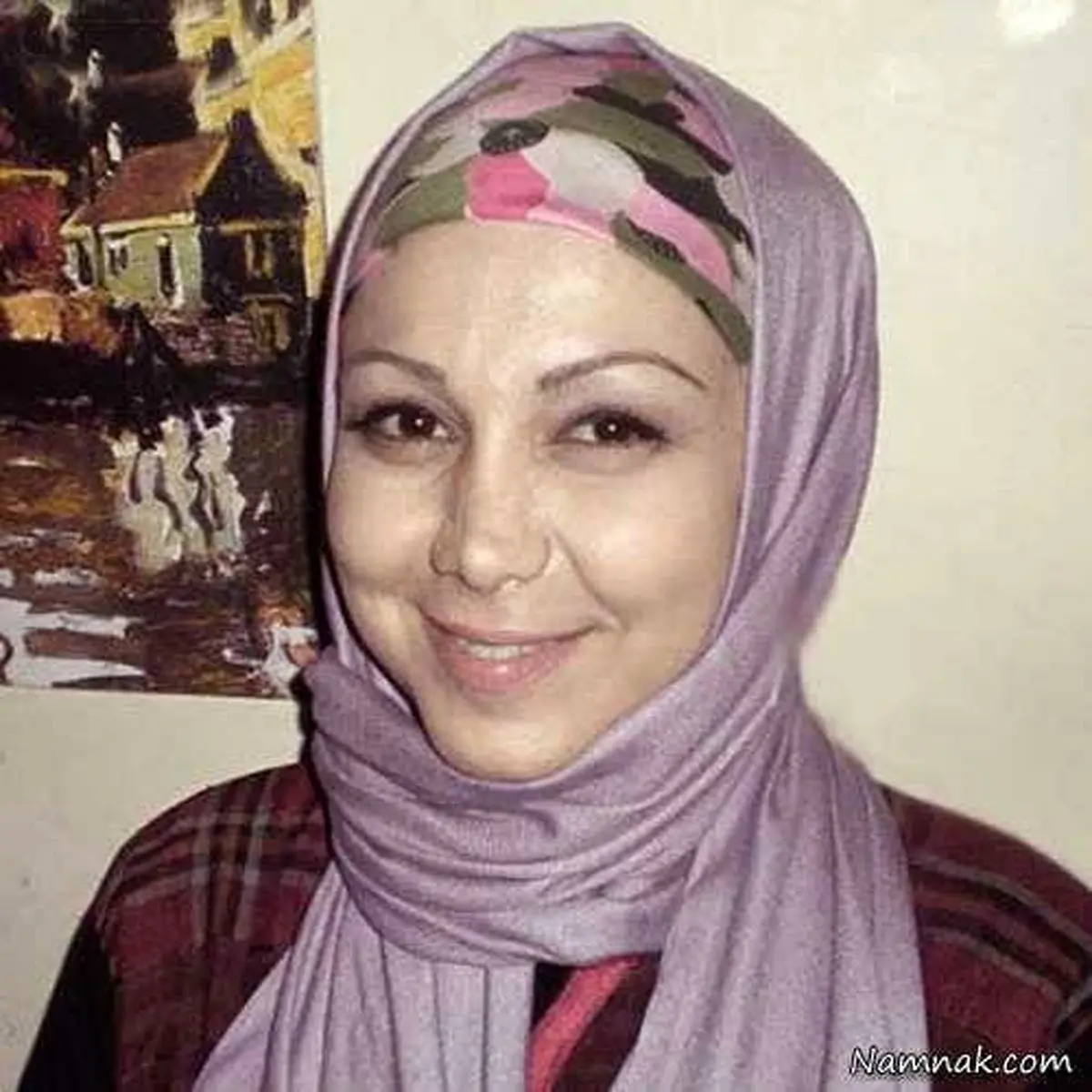 تغییر چهره بهنوش بختیاری /عکس