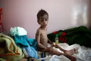 محاصره عربستان و مرگ بیش از ۱۱ هزار و ۲۵۰ بیمار یمنی